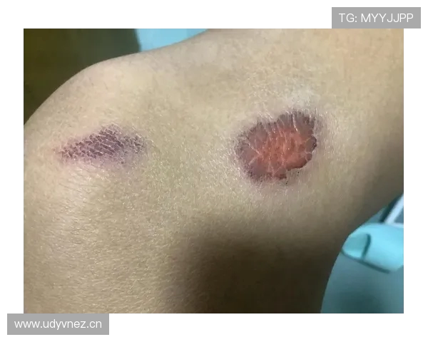 足球运动员的伤病预防与康复方法